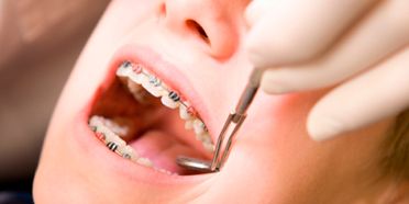 Clínica Dental Binai revisión de ortodoncia