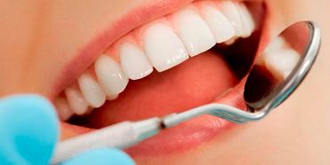 Clínica Dental Binai dientes perfectos