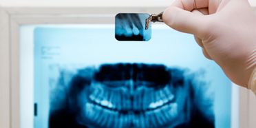 Clínica Dental Binai radiografía dental